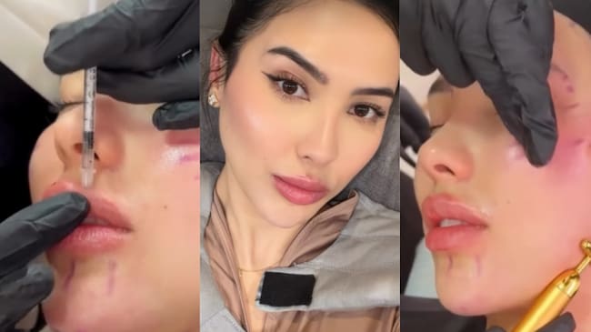 CO- Aida Merlano en su tratamiento. | Crédito: @Aidavictoriam