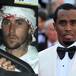 Justin Bieber no estaría bien por caso de Diddy Combs: familiares están muy preocupados