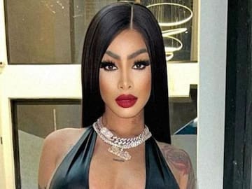 Impactante incidente: perro muerde a 'Yailin la más viral' en concierto y su reacción es oro