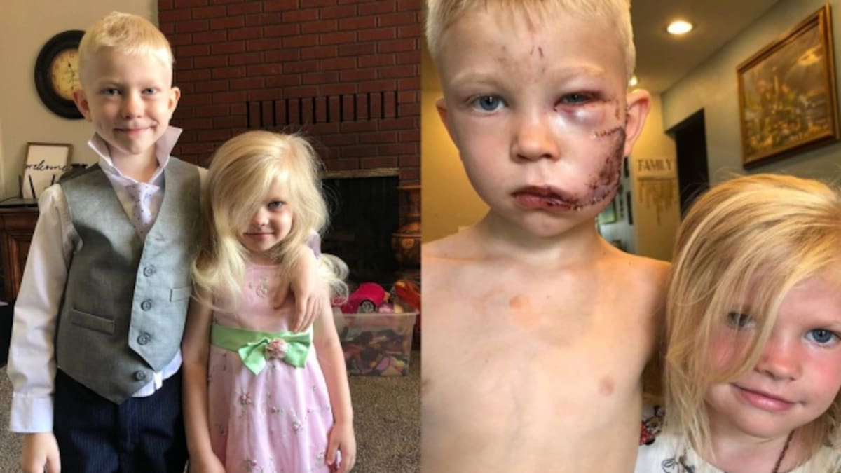 Niño es admirado por salvar a su hermana del ataque de un perro