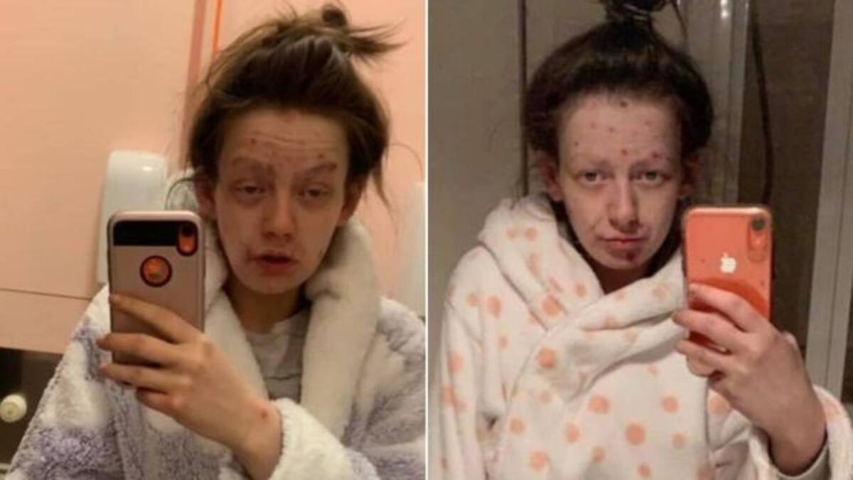 Exadicta a la heroína comparte su impactante ‘antes y después’