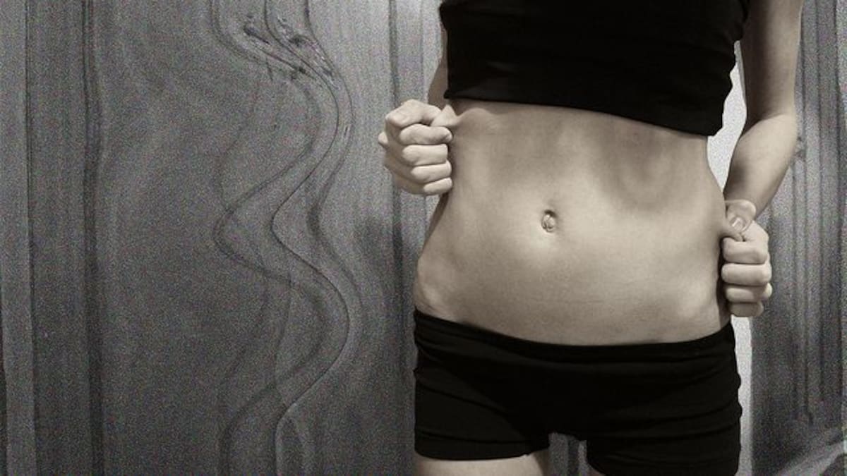 La popular youtuber que tiene a muchos preocupados por su visible enfermedad