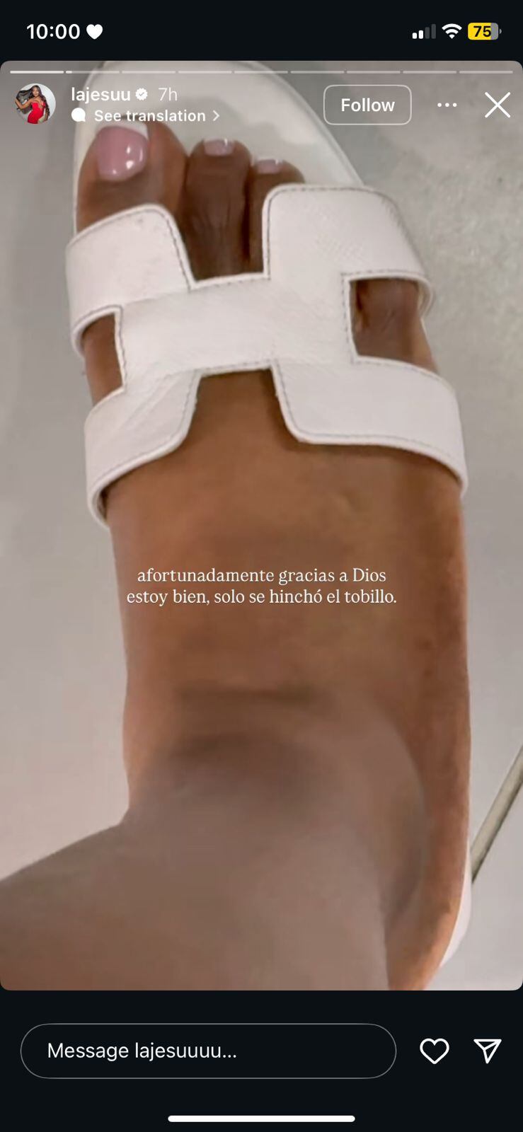 Lesión de 'La Jesuu' tras accidente | Créditos: Instagram de 'La Jesuu'