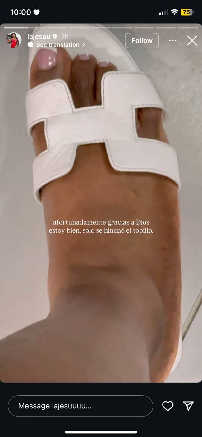 Lesión de 'La Jesuu' tras accidente | Créditos: Instagram de 'La Jesuu'