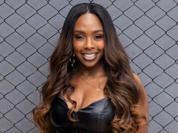 Karen Sevillano apareció en sus redes sociales con tres cirugías estéticas ¿Qué se hizo?