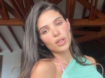 Mara Cifuentes habló sobre su cirugía de feminización facial "Yo no quería eso"