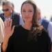 Mujer Iraní quiso parecerse a Angelina Jolie y ahora la llaman "la mujer zombie"