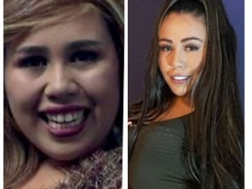 Así luce después de muchas cirugías Yina calderón