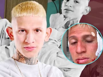 "Casi pierdo mis orejitas": La Liendra se sinceró y confesó lo que realmente le pasó