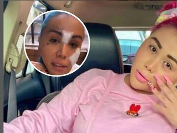 “Estoy arrepentida de verdad”: Yina Calderón muestra cómo se está quitando los tatuajes de la cara