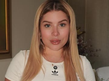 Estas son las cirugías estéticas que se ha realizado Ornella Sierra; se las hizo en un día