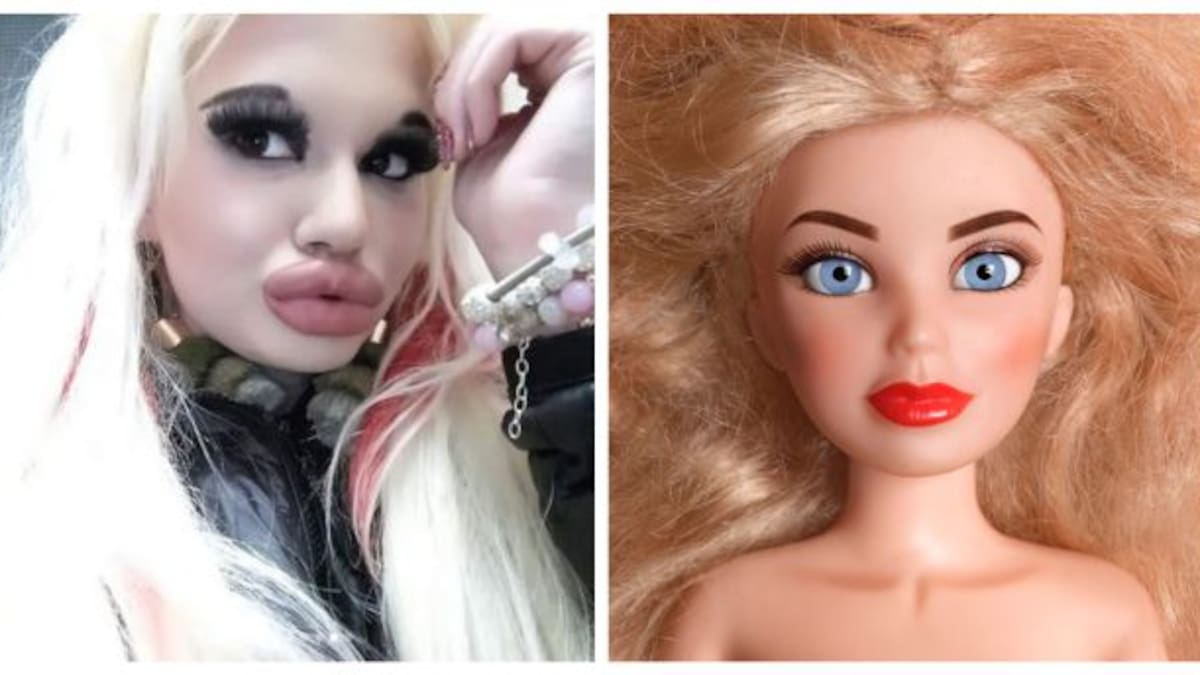 Esta es la mujer con los labios más grandes del mundo que sueña con ser la “Barbie humana”