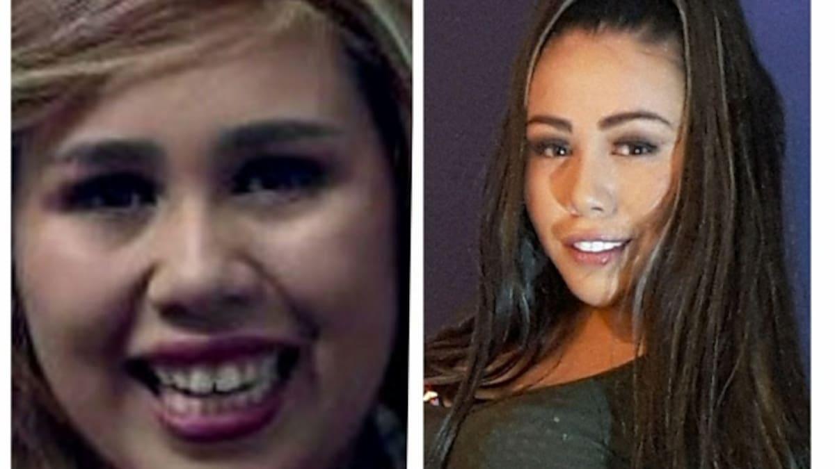 Así luce después de muchas cirugías Yina calderón