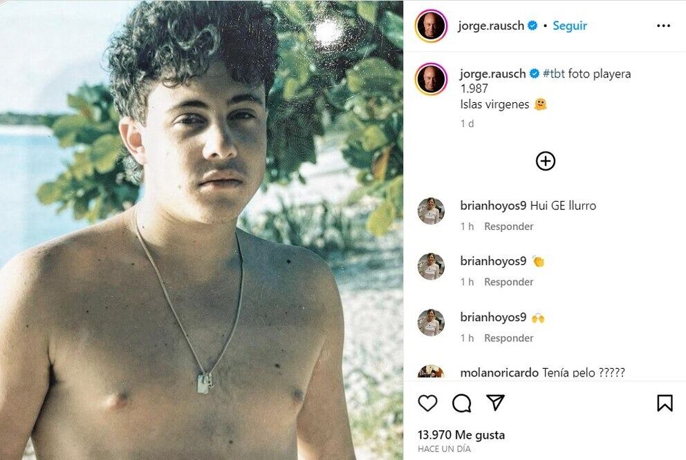 Jorge Rausch con pelo | Créditos: Instagram
