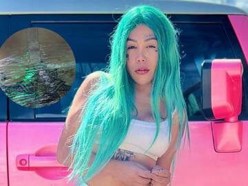 Yina Calderón muestra el tatuaje que se hizo en la cola para tapar la cicatriz que le dejaron los biopolímeros