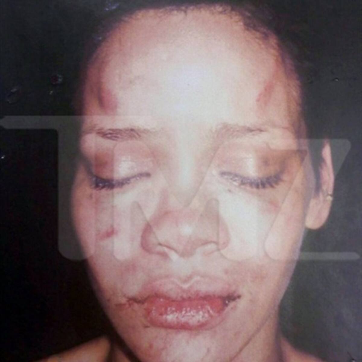 Aparece foto de Rihanna golpeada
