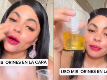Influencer causa polémica por técnica para el cuidado facial: “Me aplico mis orines en el rostro”