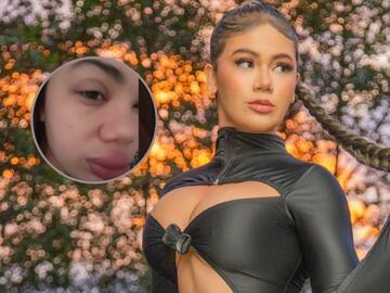 Cintia Cossio reveló la extraña enfermedad que padece desde niña y preocupó a sus seguidores