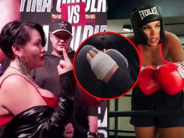 Yina Calderón arremete contra Andrea Valdiri tras su lesión: "es puro show"