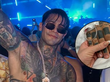 Yeferson Cossio habría sido hospitalizado de emergencia; esto revelaron sus hermanas