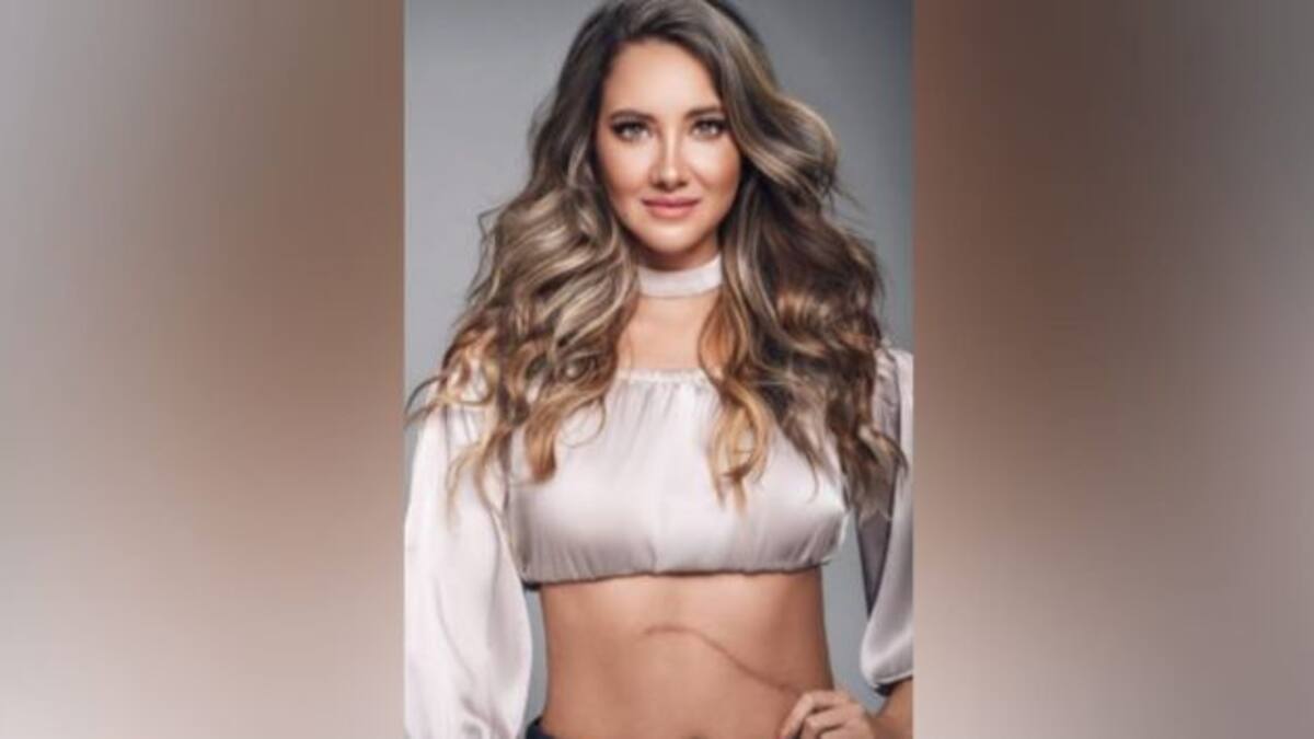 Daniella Álvarez reveló que tuvo coronavirus tras la amputación de parte de su pierna