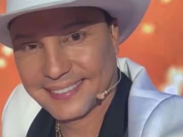 Giovanny Ayala se sometió a un difícil procedimiento para poder lucir más joven